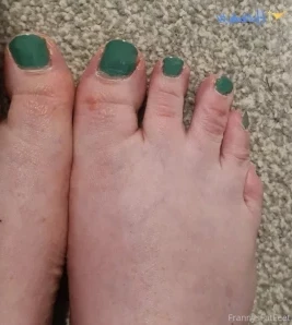 Frannysfatfeetfree - Daily foot inspection from 17th May 2021 Get up