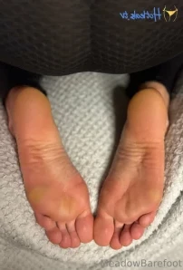 Meadowbarefoot - Morning feet freaks I recently injured my eye and