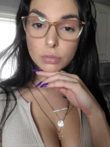 Kittycatnat111 - Fine How about my extremely swollen eyelid